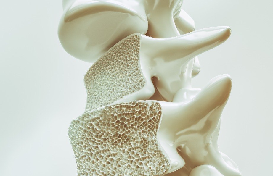Osteoporoza kręgosłupa